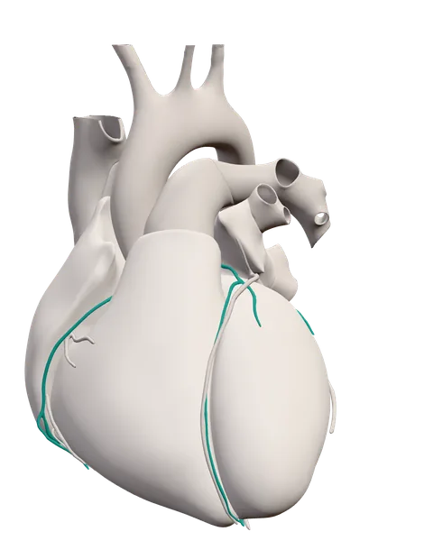 Anatomical model of the human heart and great vessels, seen from the front.